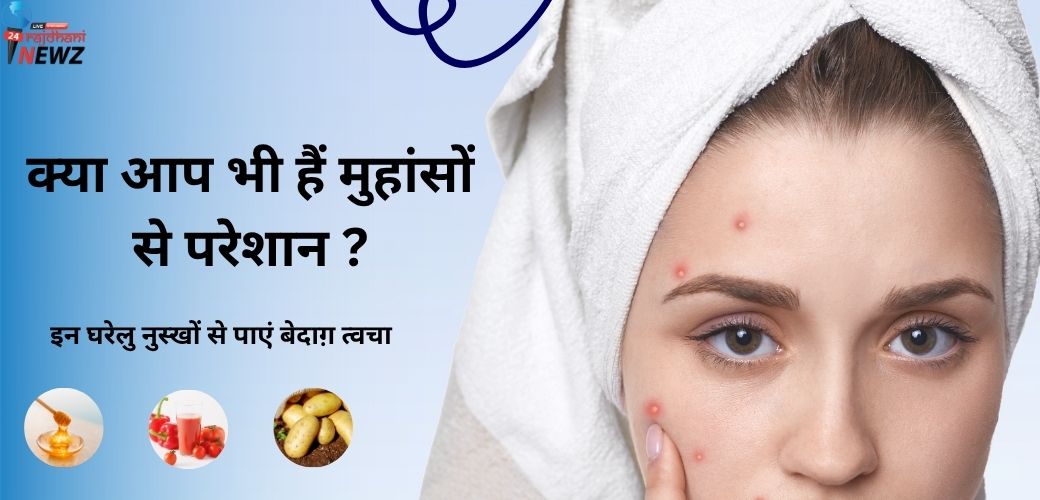 मुहांसों के लिए घरेलु नुस्खे